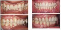 Elos Elite Lingual Orthodontists image 4